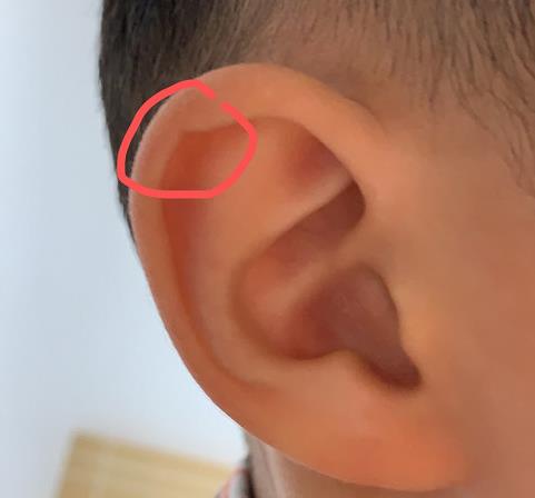 耳朵反骨真正位置图片图片