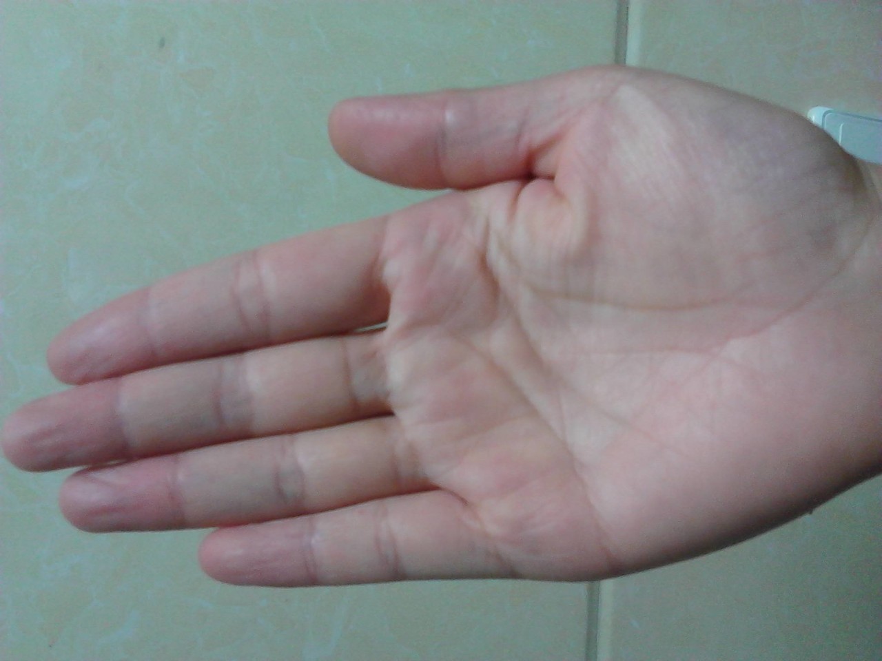 手相与健康：这种手相代表身体有病变的苗头